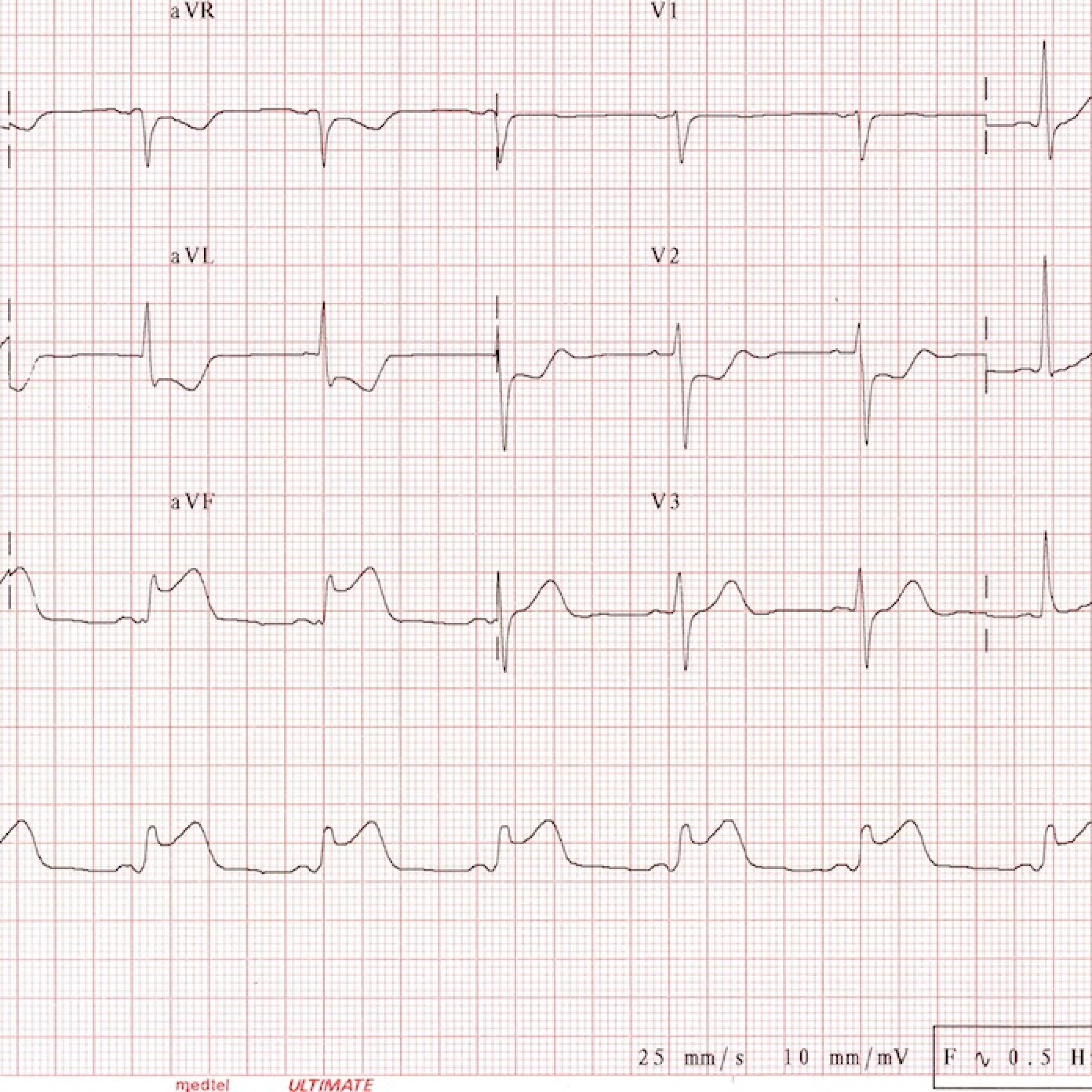 EKG - EMC Medical Training